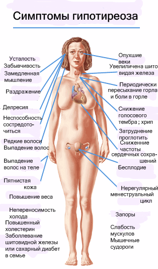 Гипотиреоз: симптомы и лечение у женщин, причины, профилактика