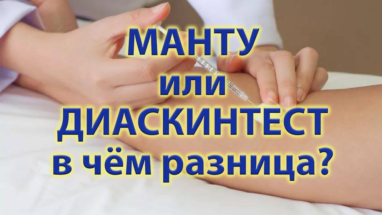 Что такое диаскинтест. Диаскинтест противопоказания у детей. Туберкулинодиагностика (проба манту с 2 те). Диаскинтест противопоказания к применению.