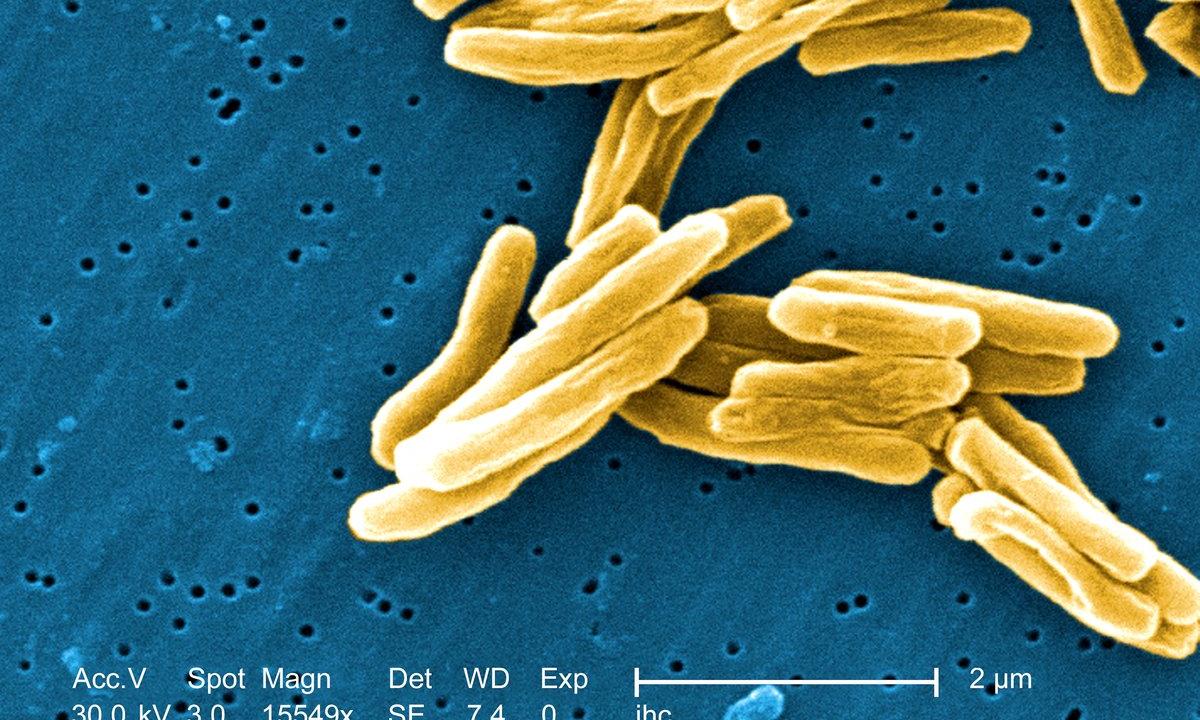 Анализ на микобактерии туберкулеза - запись пользователя каракулька (id1823911) в сообществе детские болезни от года до трех в категории анализы, узи, рентген - babyblog.ru