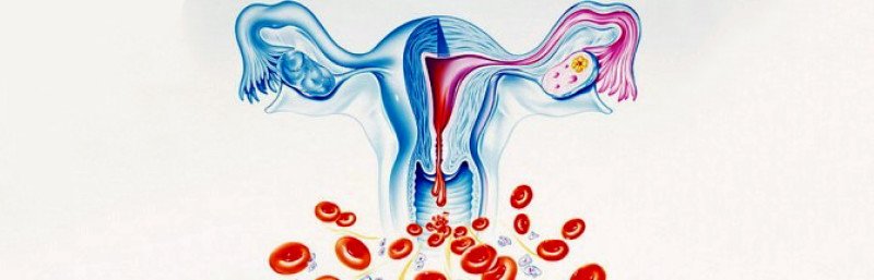 По каким причинам возникает обильная менструация