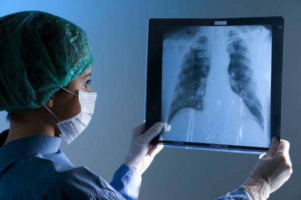 Рентген или манту детям: равно опасный выбор