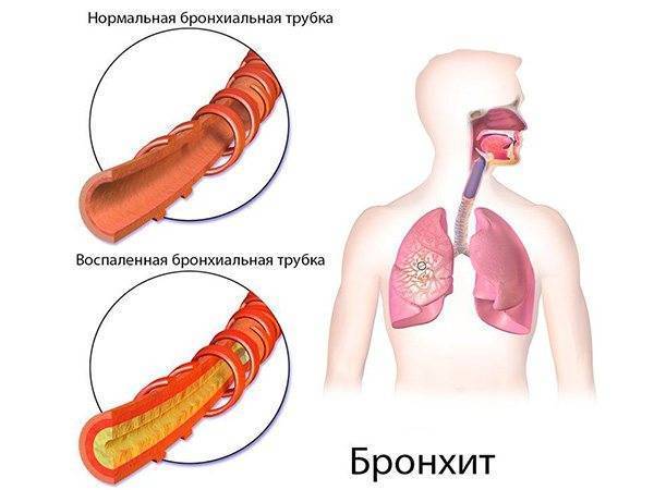 В носоглотке скапливается слизь чем лечить. Смотреть фото В носоглотке скапливается слизь чем лечить. Смотреть картинку В носоглотке скапливается слизь чем лечить. Картинка про В носоглотке скапливается слизь чем лечить. Фото В носоглотке скапливается слизь чем лечить