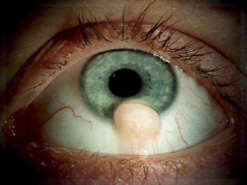 Причины и меры профилактики: почему белки глаз желтеют