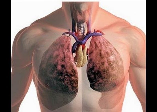 Препарат от астмы «cолутан»