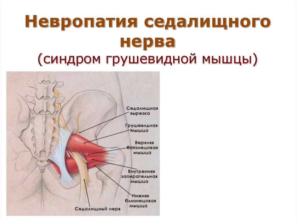 Невропатия полового. Внутренняя запирательная мышца и грушевидная мышца. Синдром мышевидной мышцы. Синдром грушевидной мышцы. Грушевидная мышца и седалищный нерв.