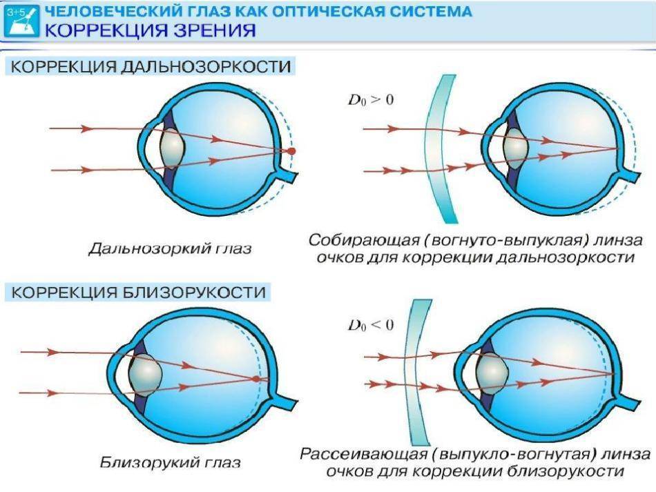 У близоруких людей изображение фокусируется перед