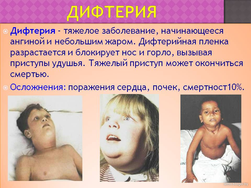 Прививка инфанрикс.кто делал?безопасно ли? - запись пользователя алинушка (puricica) в сообществе здоровье новорожденных в категории прививки - babyblog.ru