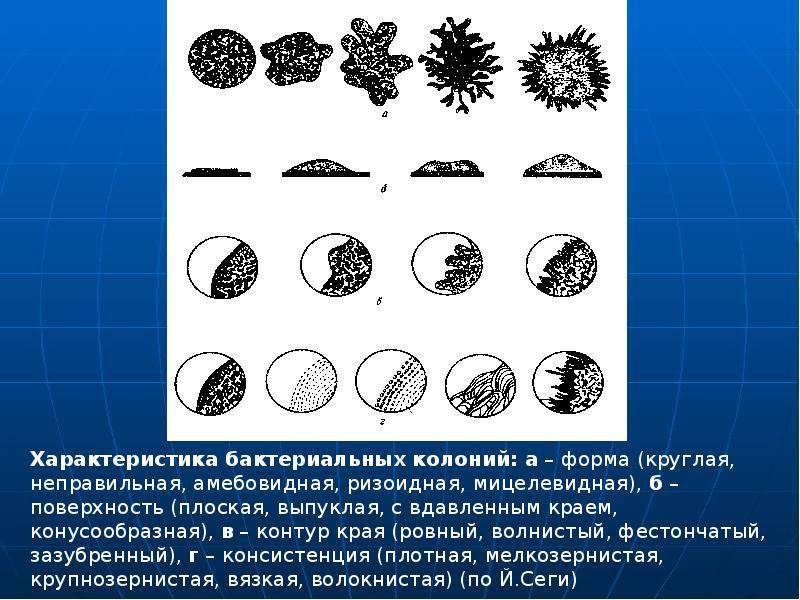 Схема описания колоний бактерий