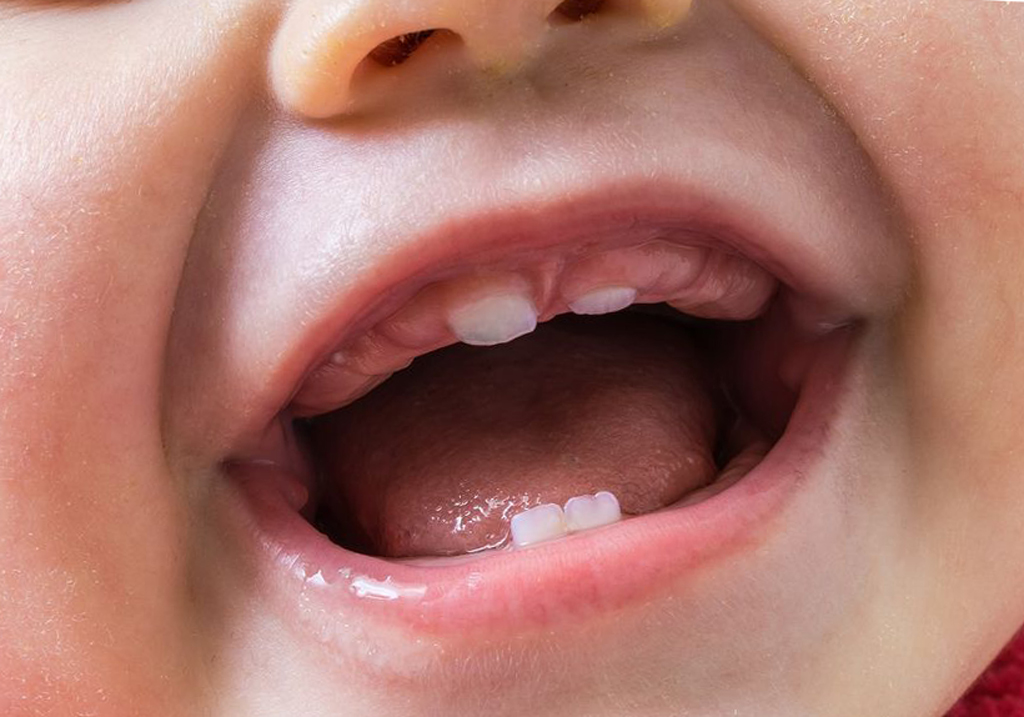 Прорезывание зубов у детей до года, температура при прорезывании