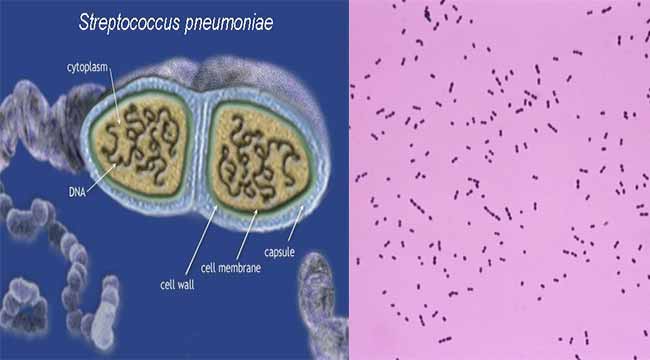 Streptococcus pneumoniae. Streptococcus pneumoniae микроскопия. Streptococcus pneumoniae поверхность. Streptococcus pneumoniae гифка. Streptococcus pneumoniae срез бактерии.