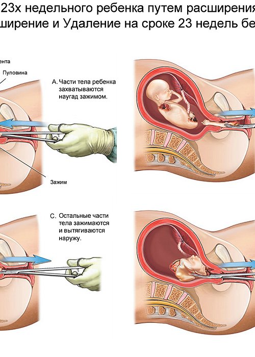 Как отличить пмс от беременности? ключевые признаки до задержки месячных