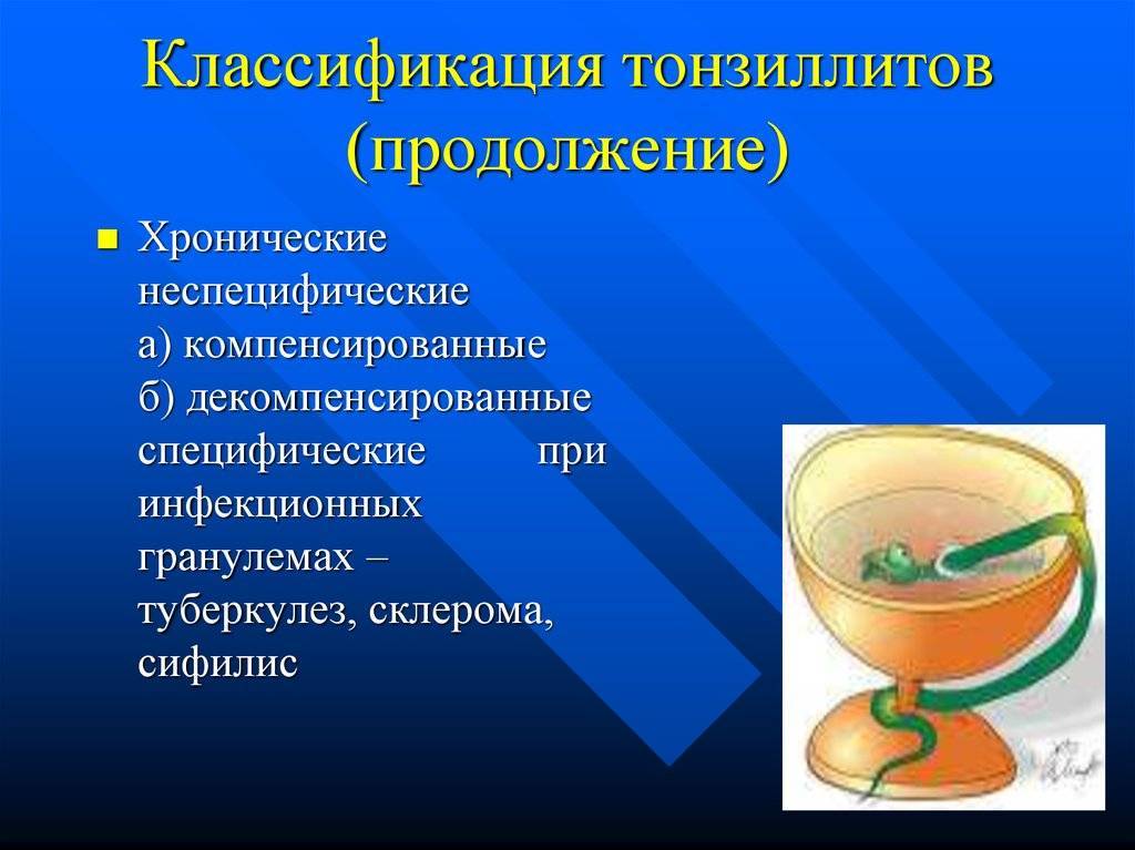 Хронический декомпенсированный тонзиллит. Тонзиллит классификация. Хронический тонзиллит классификация. Острый тонзиллофарингит классификация. Неспецифические острые тонзиллиты.