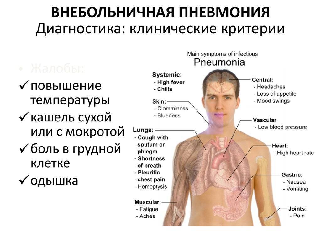Жар без температуры причины у мужчин. Пневмония симптомы внебольничной пневмонии. Локализация боли при пневмонии. Боль в грудной клетке. Боль и дискомфорт в грудной клетке.