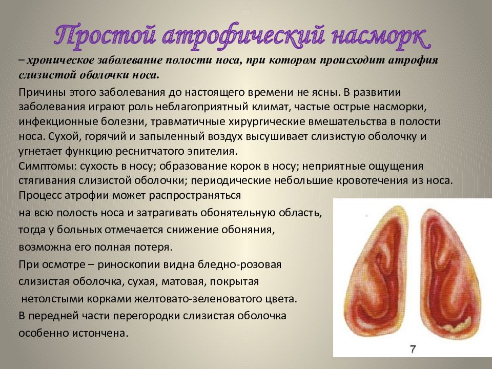 Хронический ринит презентация