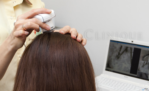 Проблемы выпаденияи лечения волос у женщин