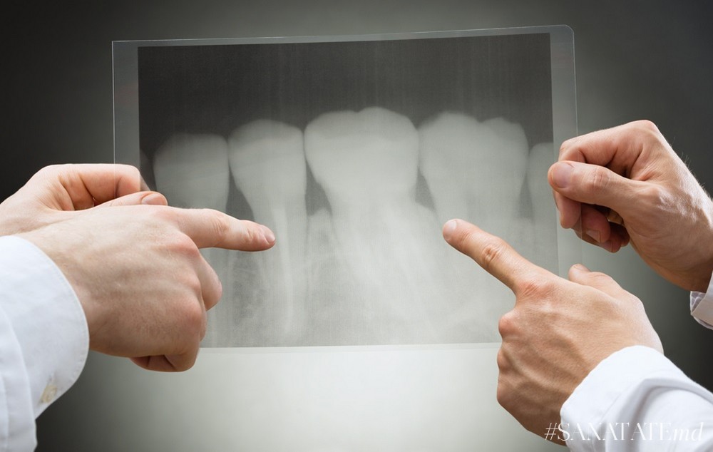Гранулема зуба – причины и симптомы патологии