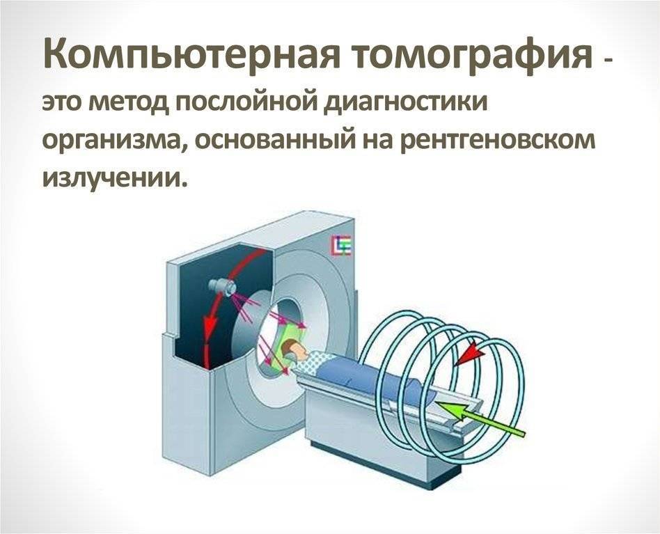 Схема получения изображения мрт