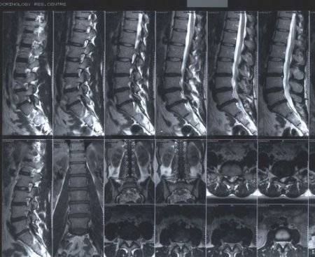 Как пройти полное обследование позвоночника