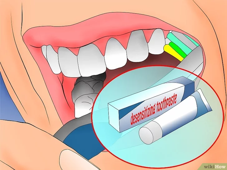 3 способа восстановить эмаль на зубах дома