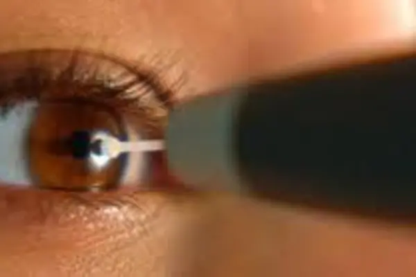 Повышенное глазное давление: признаки у взрослых и детей