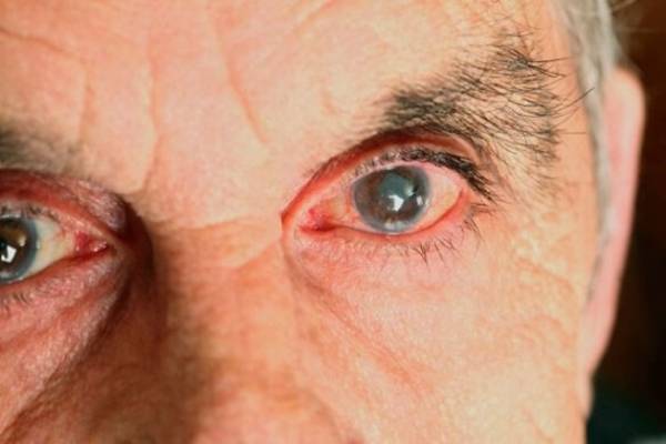Здоровье глаз: методы проверки внутриглазного давления