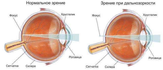 Атропин глазные капли, таблетки: механизм действия, противопоказания, отзывы