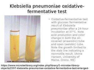 Klebsiella pneumoniae (клебсиелла пневмонии)