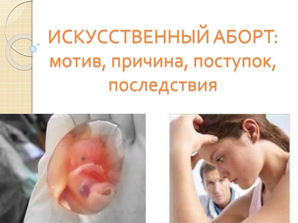 Прерывание беременности на ранних сроках | proaborty .com