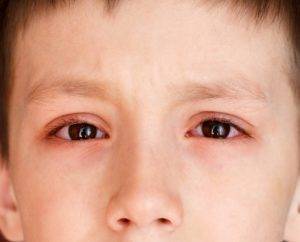Почему у ребенка красные глаза и что делать?