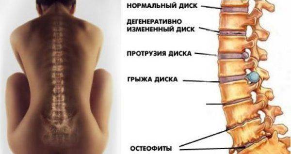 Как пройти полное обследование позвоночника