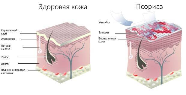 Сыпь под грудью, зуд и красные пятна у женщины: фото, причины, симптомы и лечение