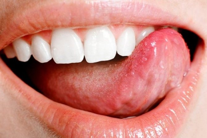 Болезни языка у человека: фото, симптомы, чем лечить, к какому врачу обращаться