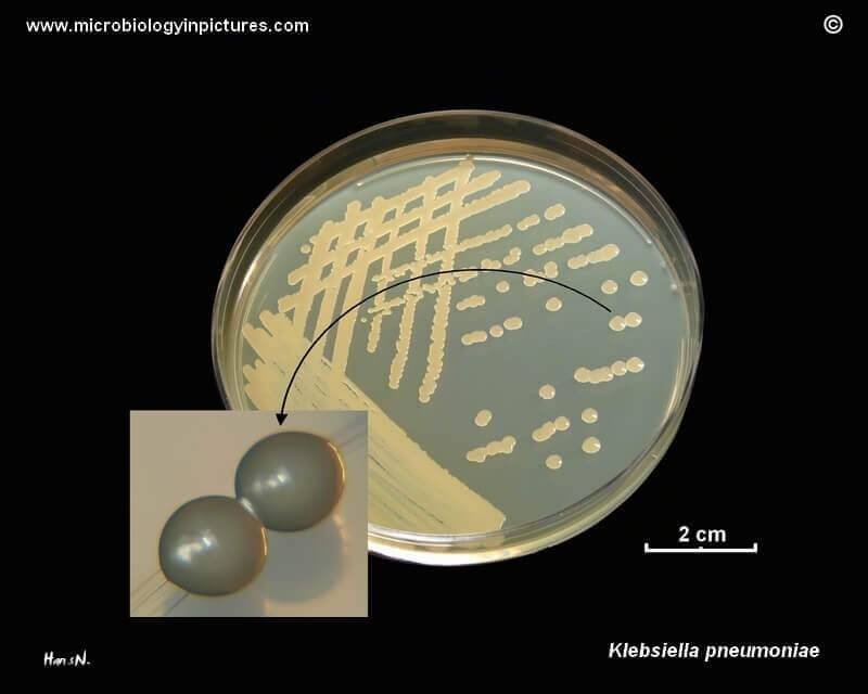 Klebsiella pneumoniae (клебсиелла пневмонии)