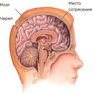 Диагностика сотрясения головного мозга