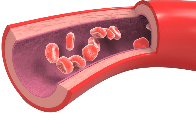 Облитерирующий эндартериит – современная диагностика и лечение опасной болезни
