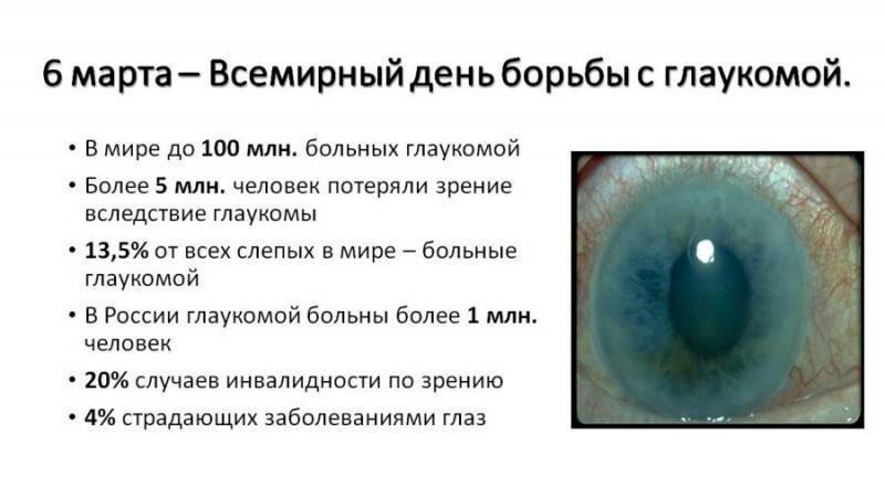 Глаукома: симптомы и лечение, что это такое - открытоугольная и закрытоугольная, признаки и острый приступ, профилактика, лечение