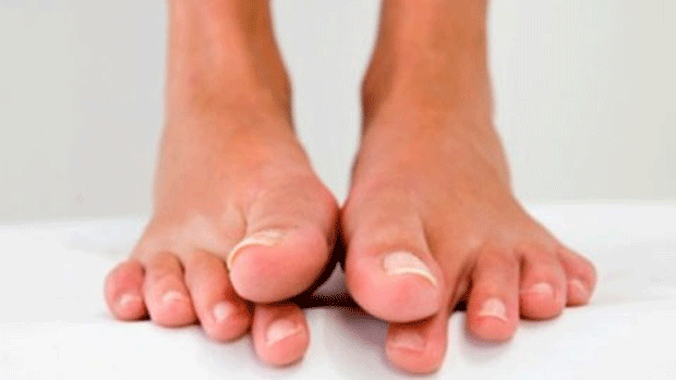 Эффективные противогрибковые средства для ногтей ног