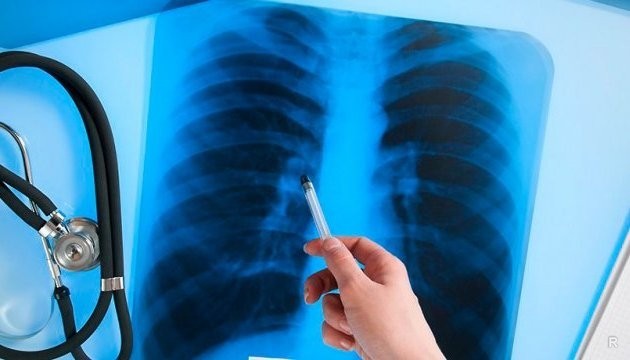 Первые проявления туберкулёза: с чего всё начинается?