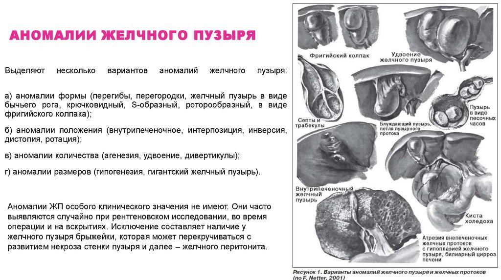 Стул при застое желчи