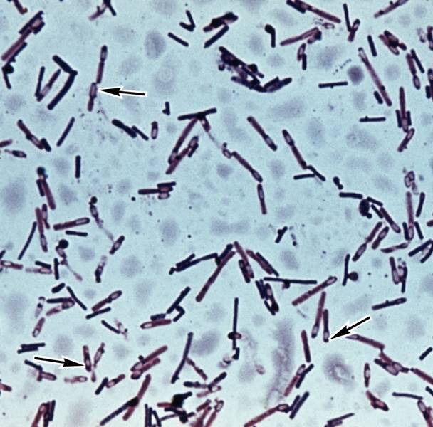 Микропрепарат бактерий. Клостридии микроскопия. Сенная палочка микроскопия. Палочки бактерии микробиология. Бактерии бациллы клостридии микробиология.