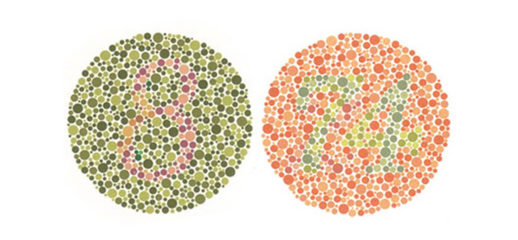 Дальтонизм и другие нарушения цветового зрения
