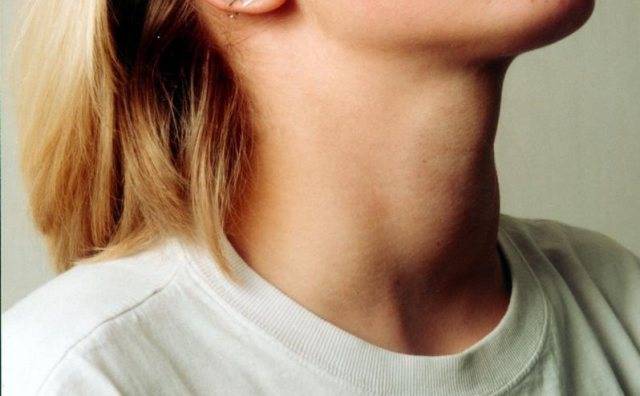 Виды зоба щитовидной железы