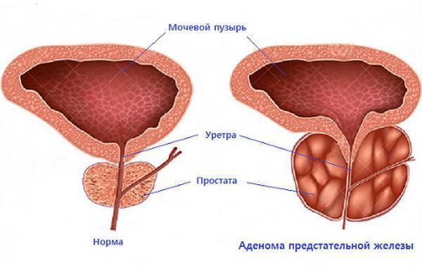 Афалаза                                            Afalaza                                                                инструкция по применению