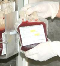 Гемотрансфузия (переливание крови): суть, показания, подвиды, проведение, осложнения