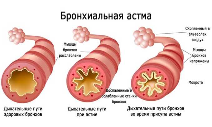 Медрол