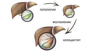 Болит поясница после сна: подробное описание причин