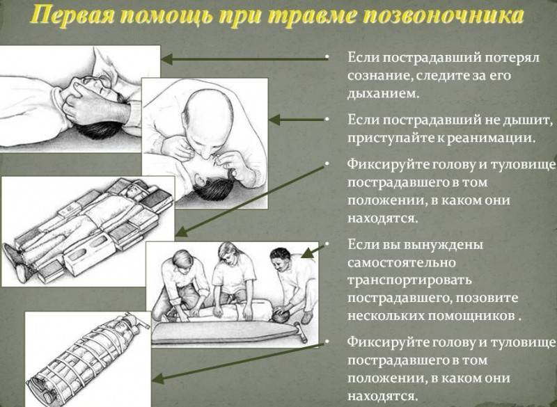 Поперечные и остистые отростки позвоночника