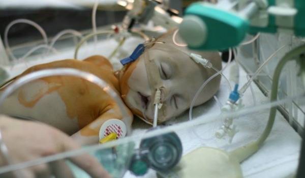 Смертность новорожденных детей от пневмонии
