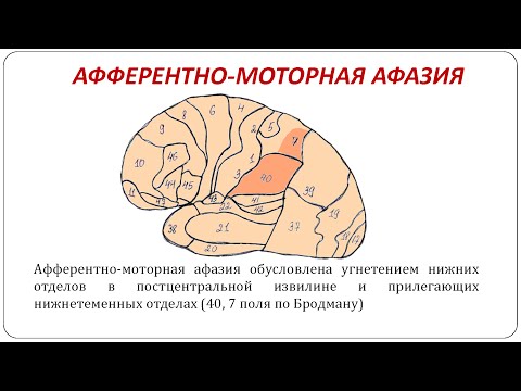 Афферентная кинестетическая моторная афазия