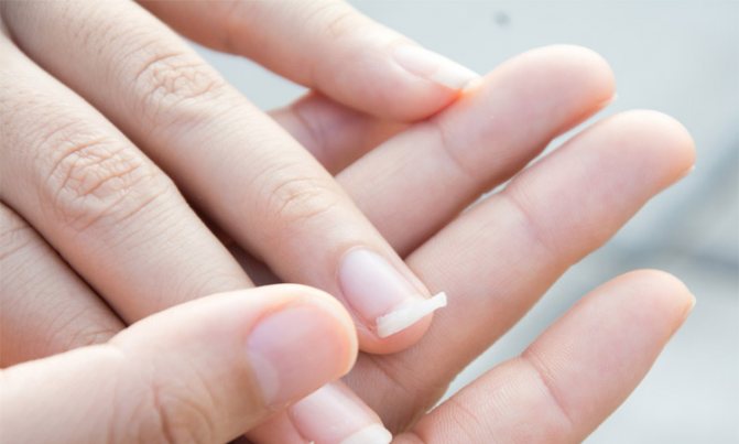 6 способов как укрепить слоящиеся ногти в домашних условиях